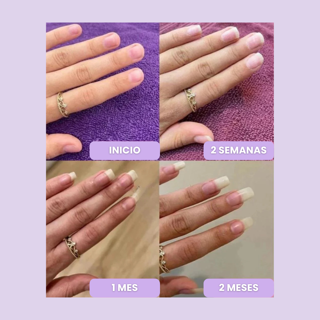 CutiCare™ - Fortalece y Acelera el Crecimiento de tus Uñas