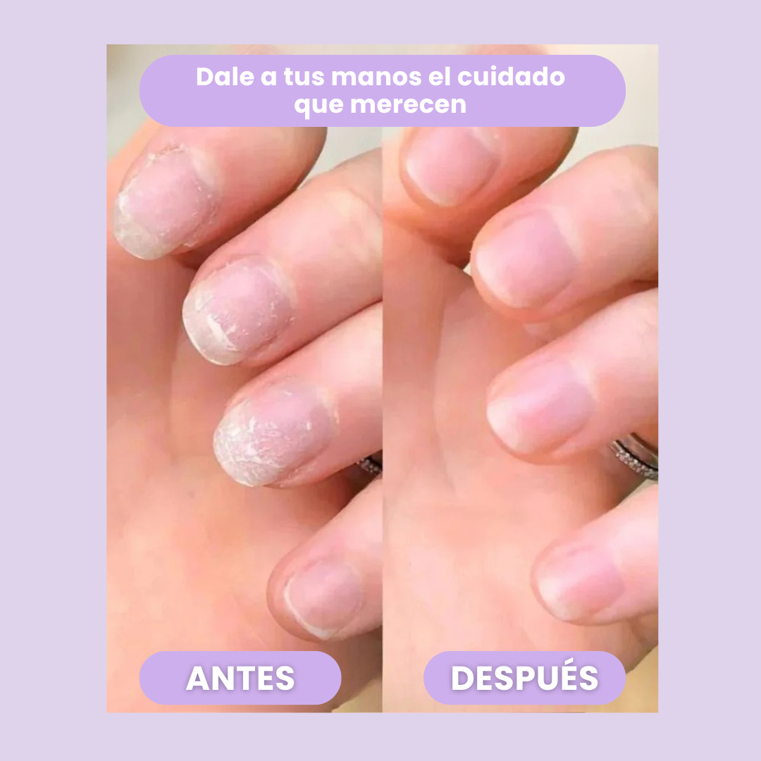 CutiCare™ - Fortalece y Acelera el Crecimiento de tus Uñas