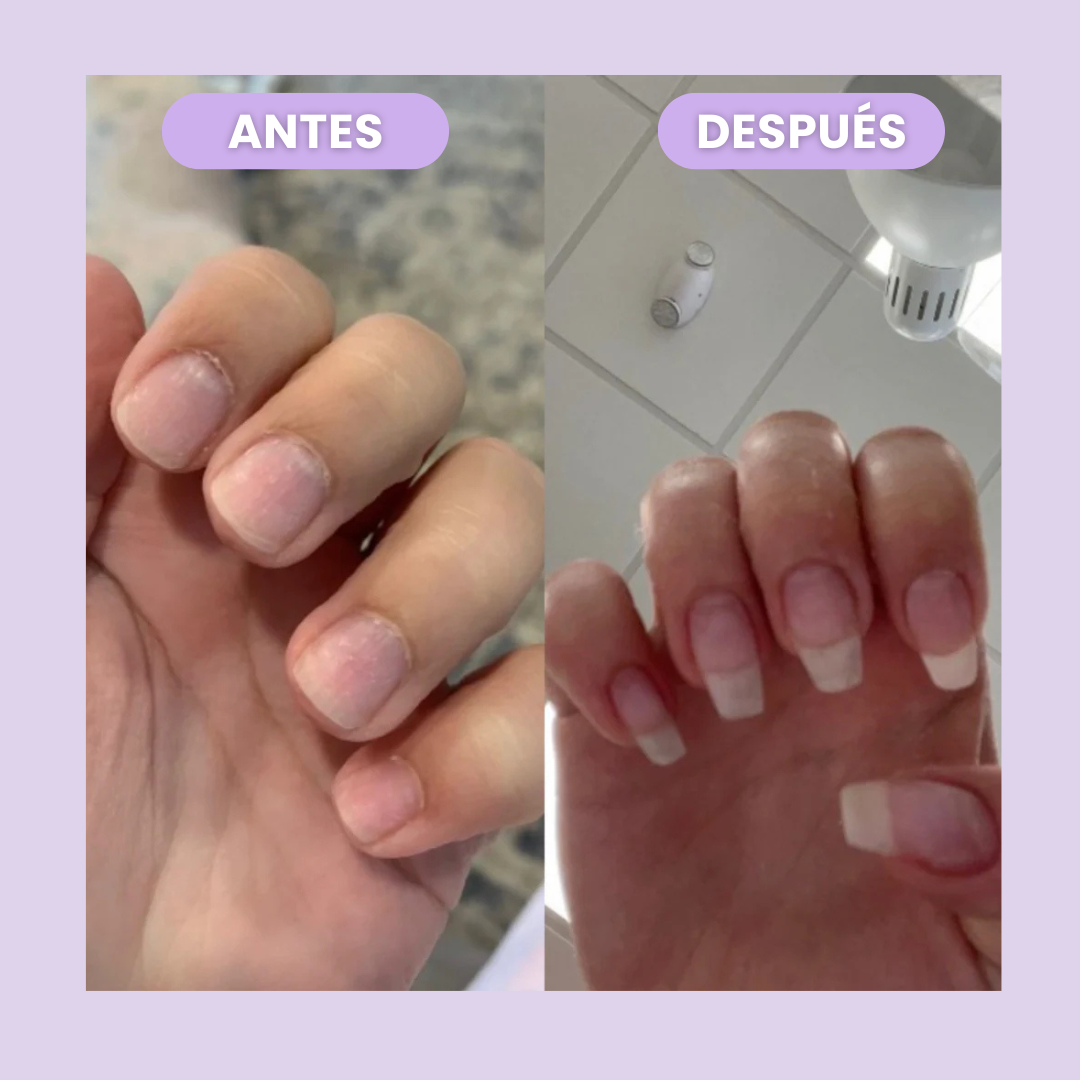 CutiCare™ - Fortalece y Acelera el Crecimiento de tus Uñas