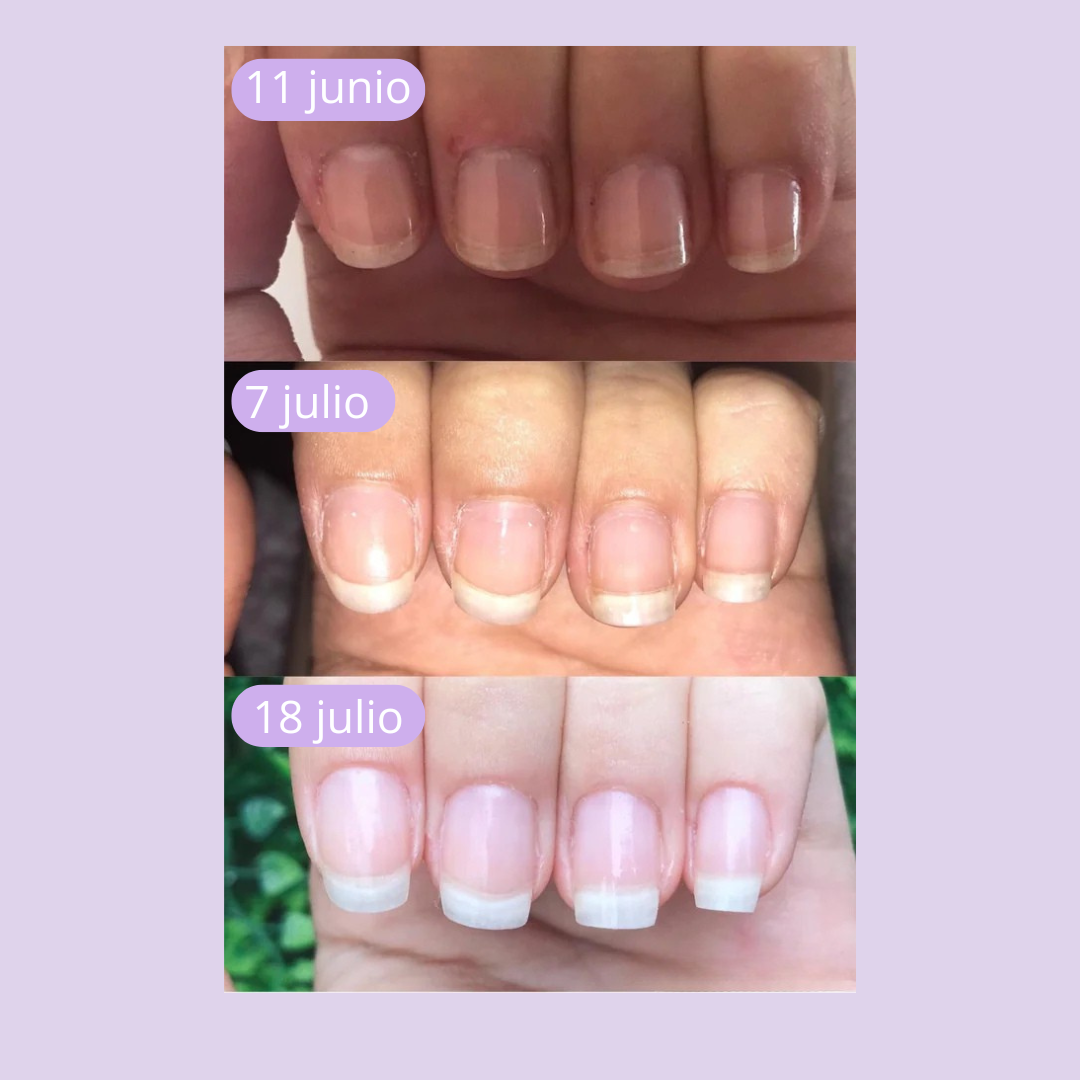 CutiCare™ - Fortalece y Acelera el Crecimiento de tus Uñas